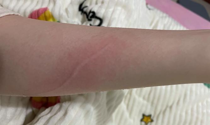 小猫咬人后的持续时间有多久？（了解小猫咬人后可能出现的持续时间和影响力）