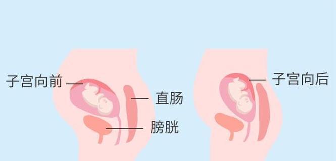 从怀孕到肚子凸出，需要多久？（探寻孕妇肚子凸出的时间和关键因素）