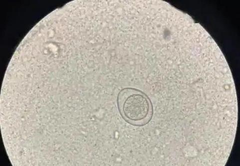 宠物感染球虫的治疗周期及关键因素分析（以宠物感染球虫多久能够完全康复？治愈时长与相关因素）