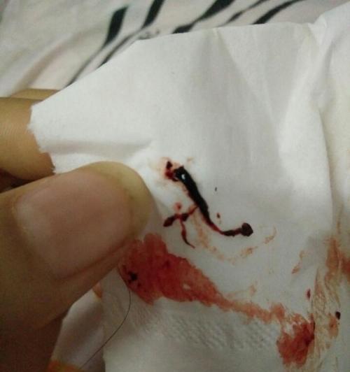 流产的先兆症状及预防措施（了解先兆症状，守护胎儿健康）