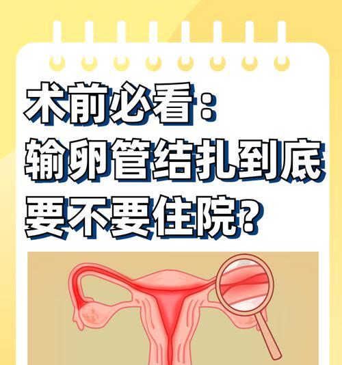 结扎手术（解析结扎手术的康复时间及注意事项）
