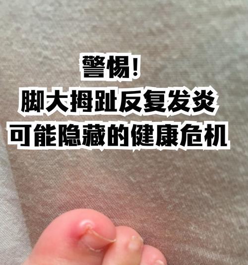 猫咪甲沟炎的原因与症状解析（不洗脚惹的祸？了解猫咪甲沟炎的初期症状）