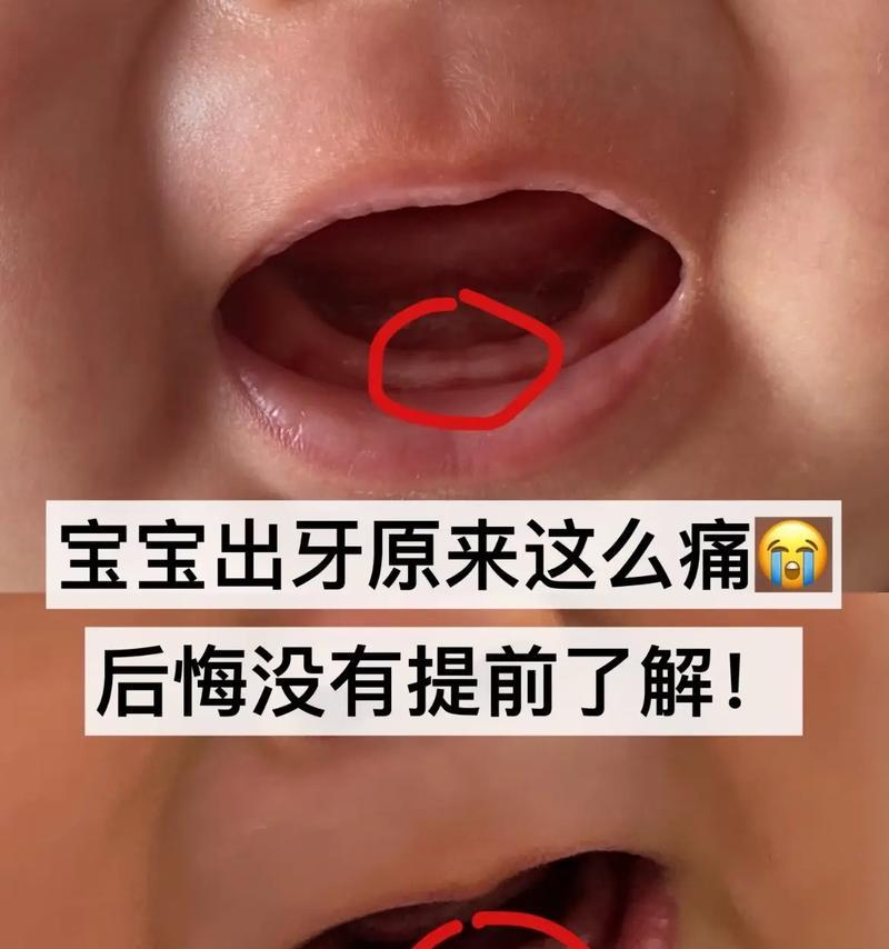 小狗的牙齿生长周期（了解小狗出牙周期，为宠物护齿做准备）