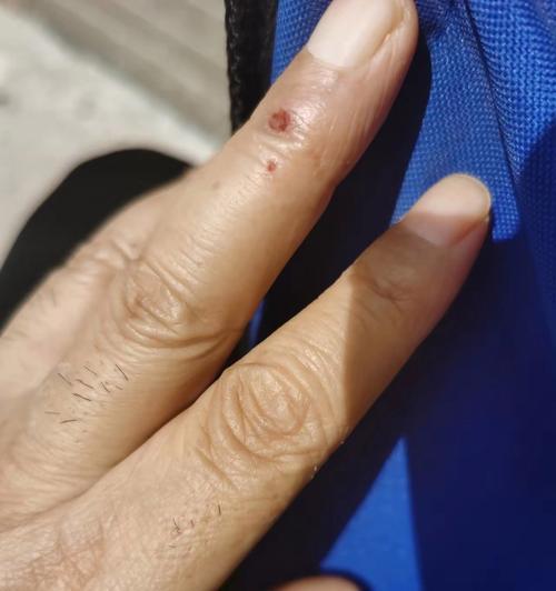 狗疫苗鼓包问题解析（疫苗鼓包时间、原因及恢复期）